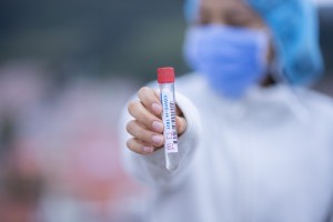 Gdzie mogę przeprowadzić test na koronawirusa?