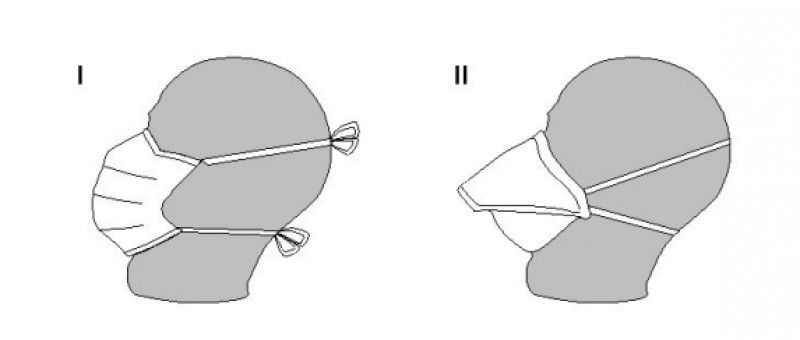 I: Typical tie mask. II: ‘Duckbill’ strap mask